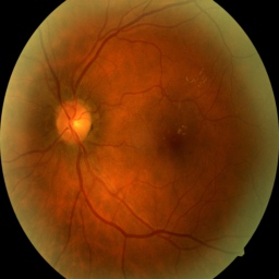 Healthy eye image.